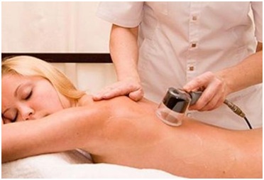 Вакуумно-баночный массаж спины в клинике  «Мудрый Доктор» в СПб